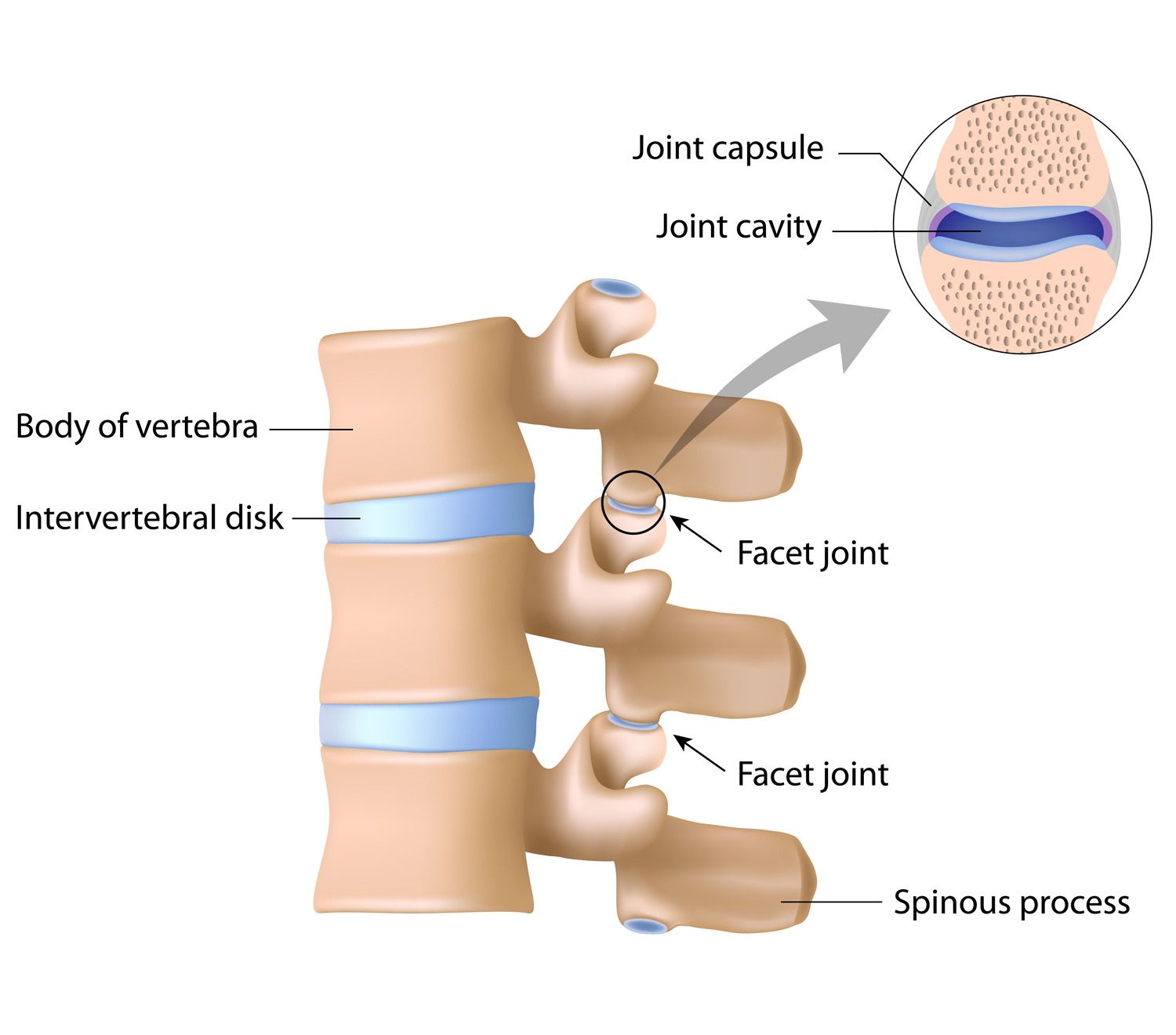 Illustration of the facet joint and what could cause facet joint syndrome
