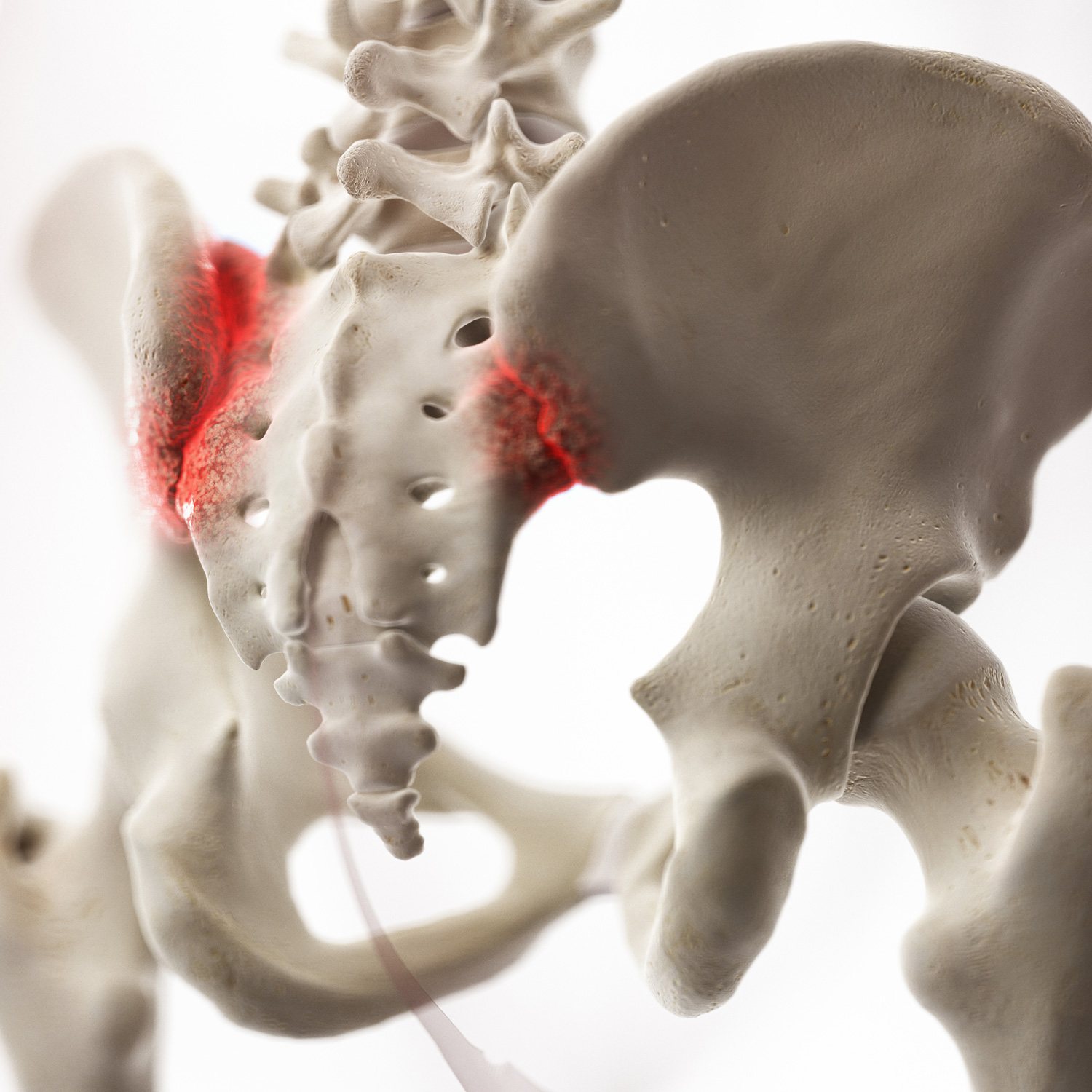 the sacroiliac (SI) joint that connects your spine to your pelvis in pain