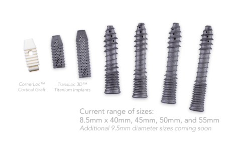 Transloc Back CornerLoc & TransLoc for SI Joint Dysfunction | Pacific Sports & Spine